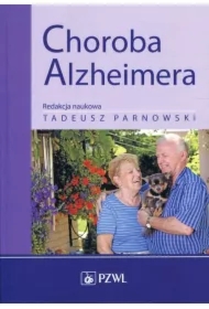 Choroba Alzheimera